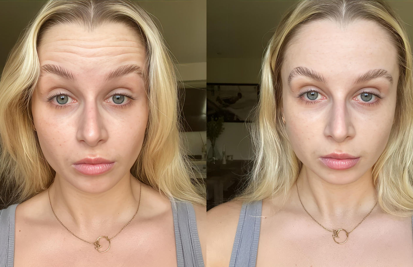 Before and after comparison showing reduced morning puffiness and tired eyes after using Skin Revive LED face massager.